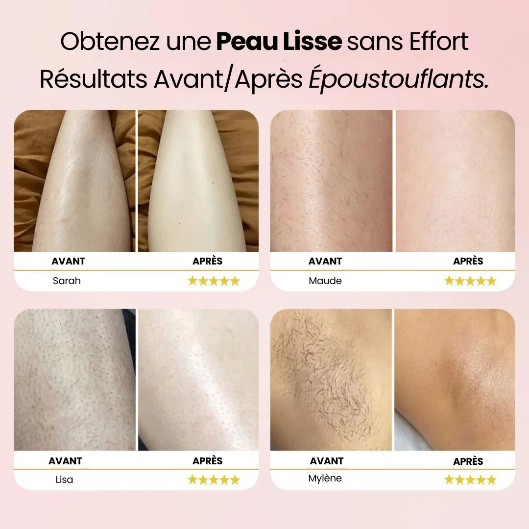 Luzea-épilateur-peau douce